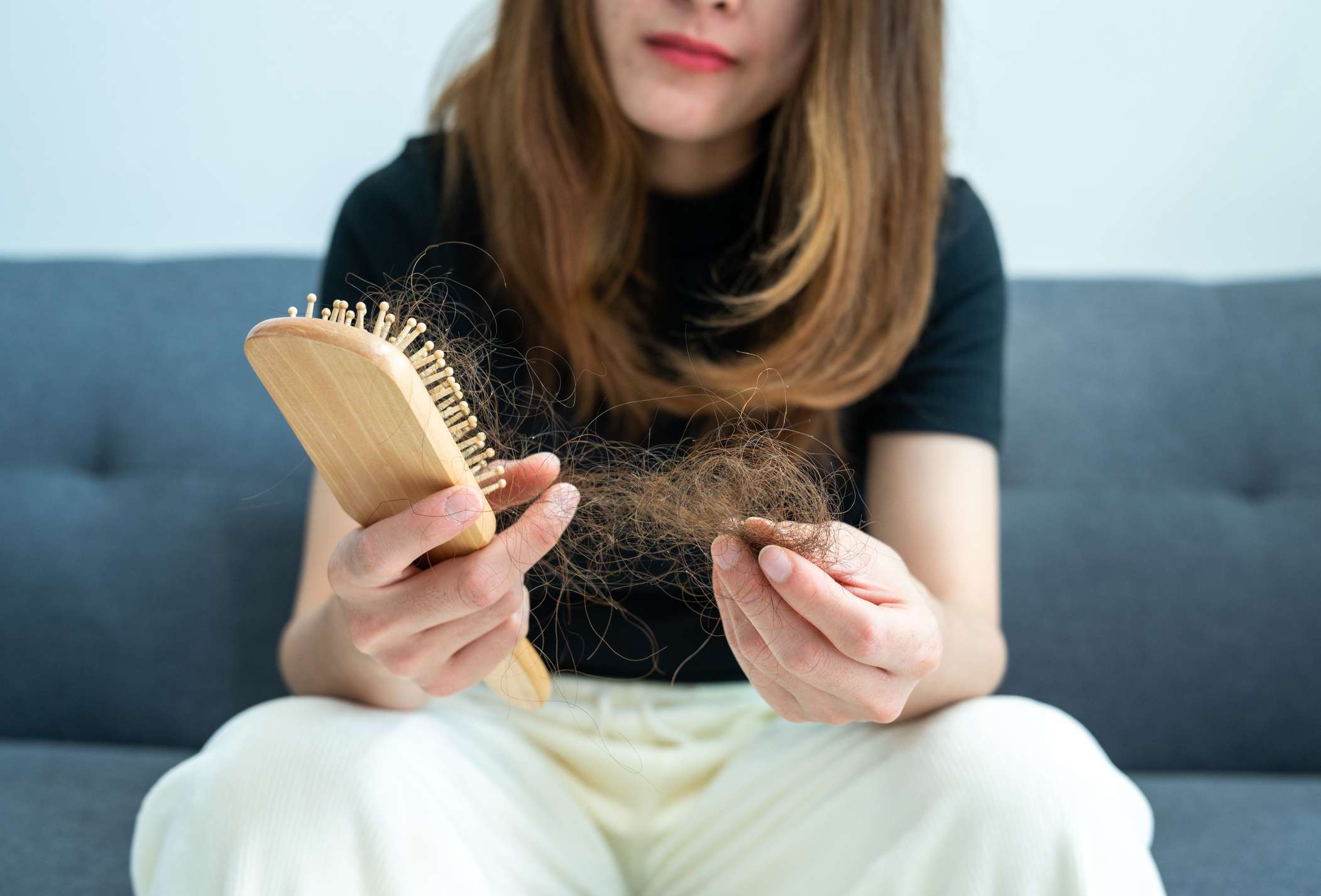 Can Stress and Anxiety Cause Hair Loss?