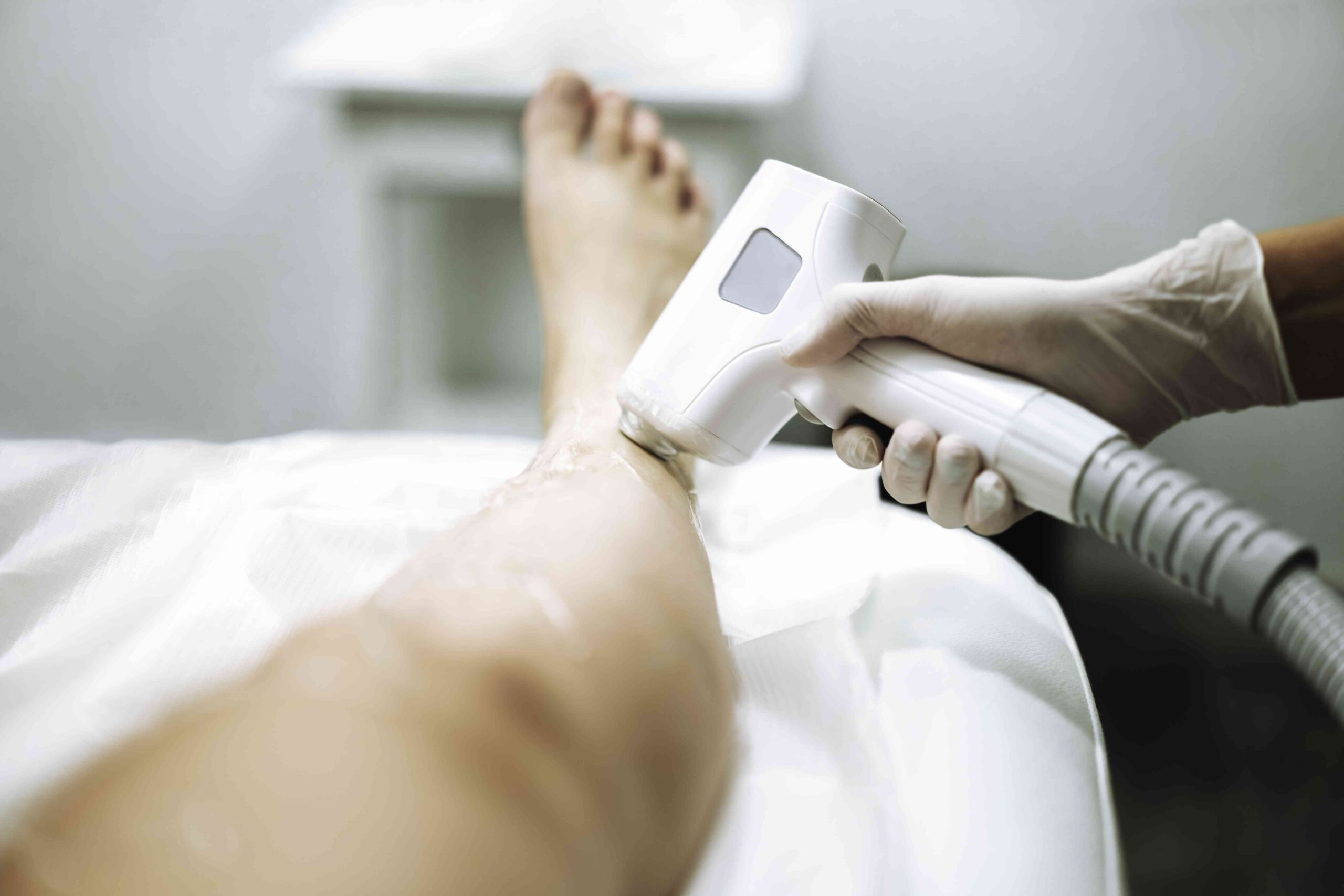 Electrolysis vs. Laser Hair Removal: Which Is Best?