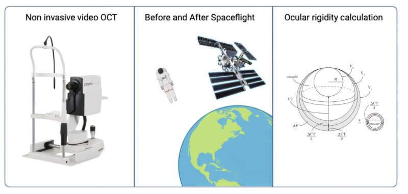 Astronauts’ eyes weaken during long space missions, raising concerns for Mars travel