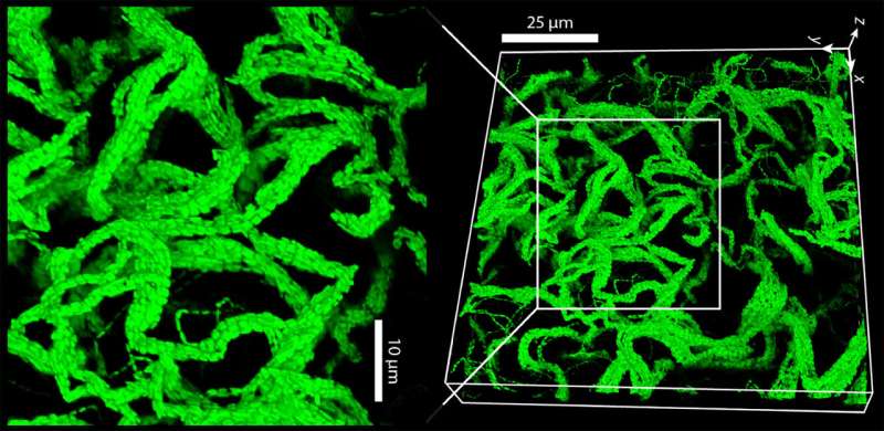 Bacteria in polymers create cable-like structures that grow into living gels