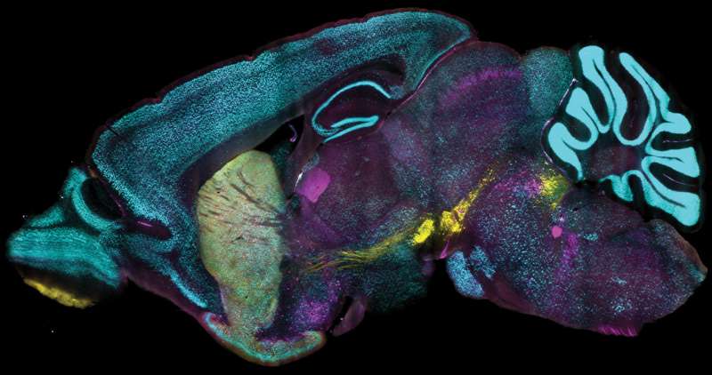 New method enables protein labeling of tens of millions of densely packed cells in organ-scale tissues