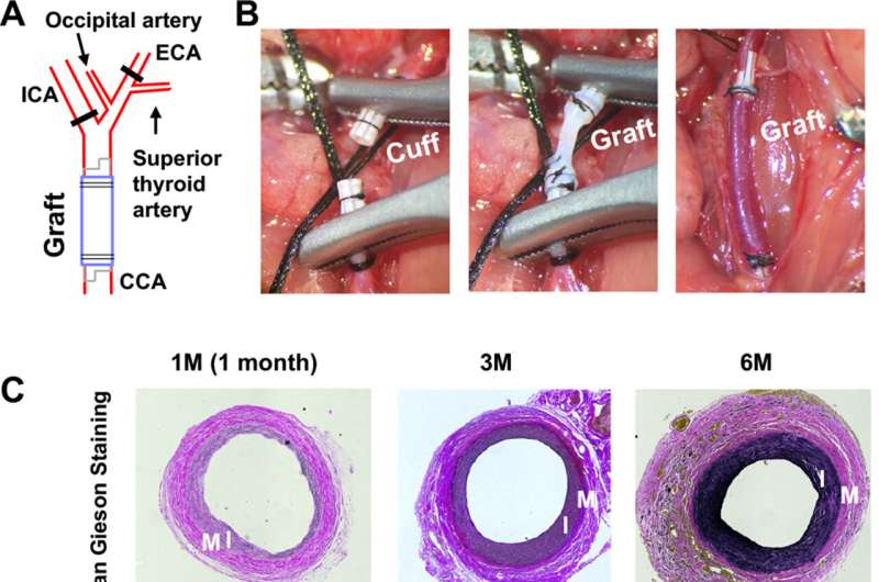 Surprising longevity of nanoparticle paste offers hope for surgery-sparing technique