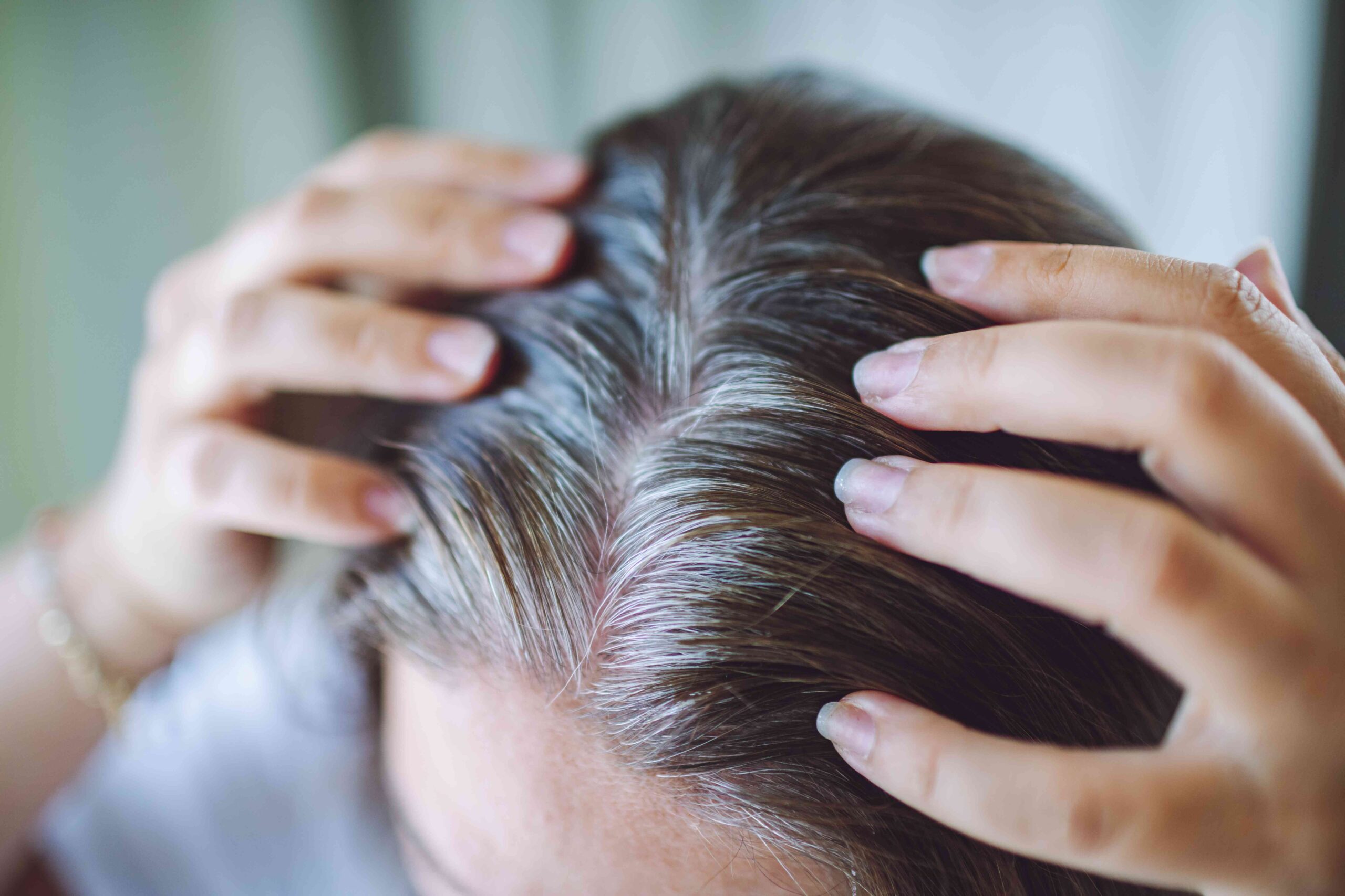 Can Eating Certain Veggies Really Prevent Gray Hair?