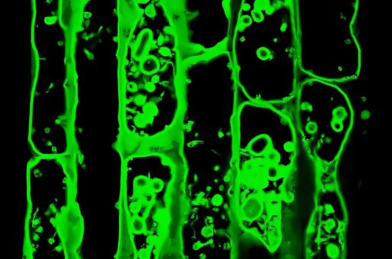 How plant cells protect their vacuoles